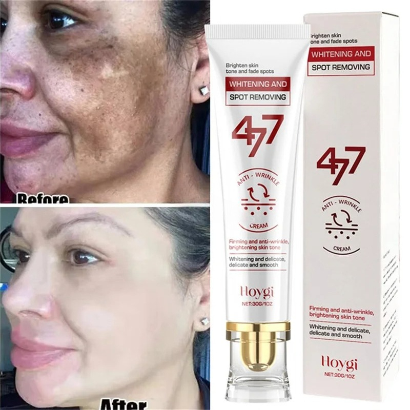Luxury Skincare Brands - Мощный отбеливающий крем для удаления пятен,