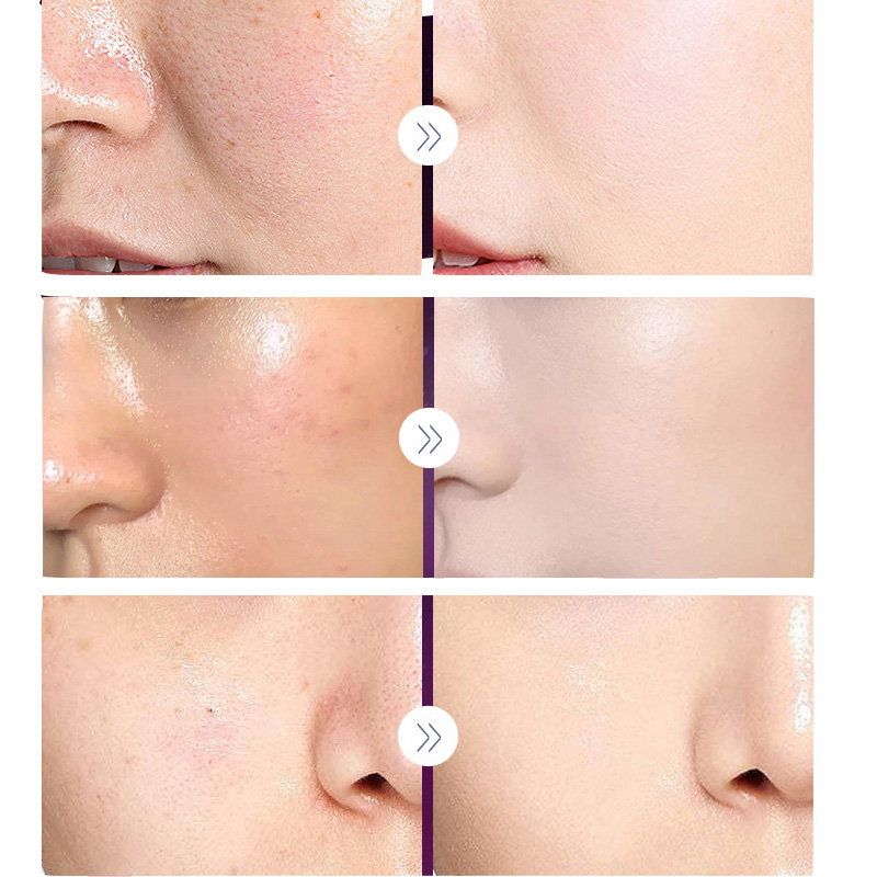Роскошный благородный фотограф – обзор и цена Luxury Skincare Whitening Cream