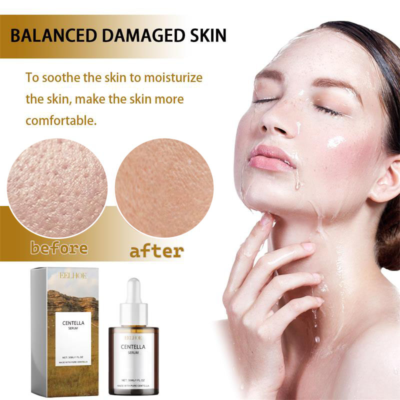 Сыворотка для лица с центеллой – обзор и цена Luxury Skincare Korea