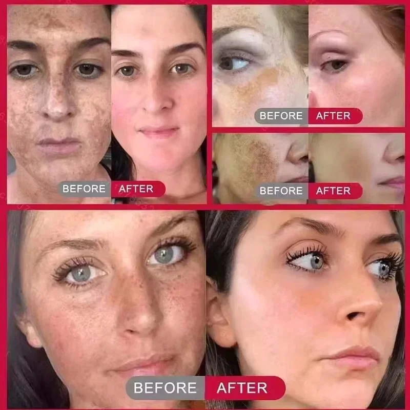Мощный отбеливающий крем для у – обзор и цена Luxury Skincare Brands